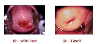 �������׵�ͼƬ