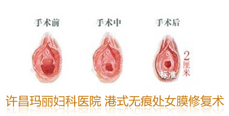 ��ŮĤ�޸���ͼƬ