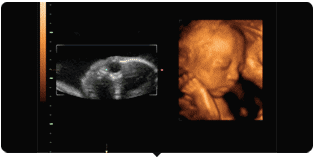 许昌玛丽医院四维彩超